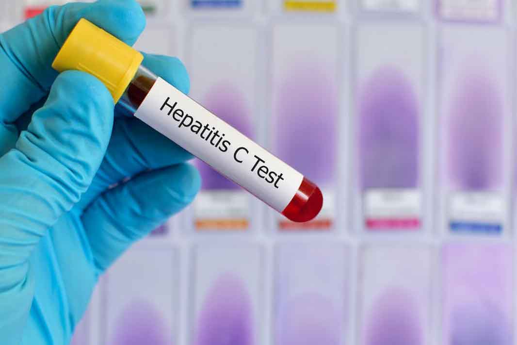 Test de hepatitis C